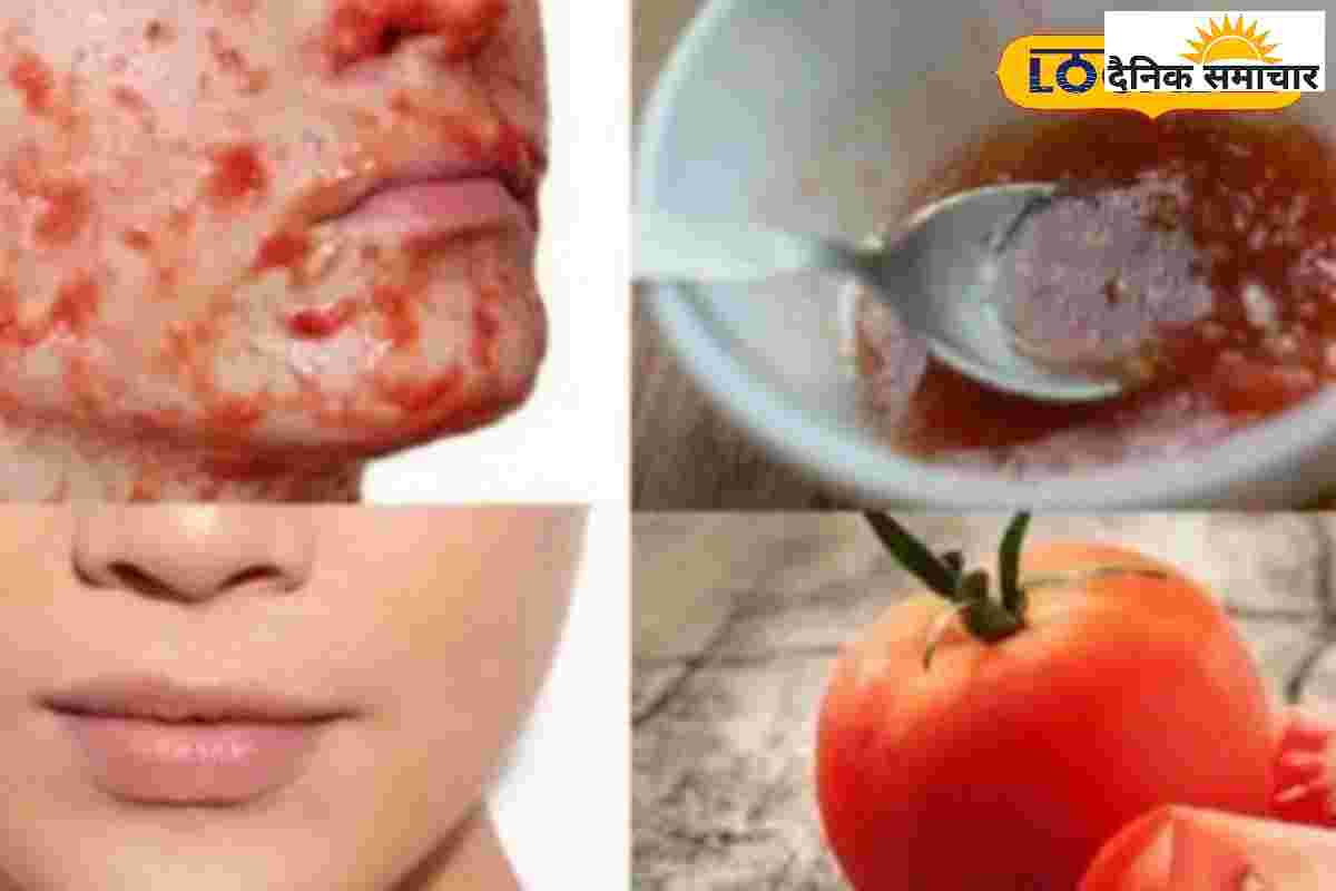 सिर्फ 15 मिनट में दिखेगा फर्क! टैनिंग मिटाएगा ये आसान नुस्खा, ऐसे करें यूज