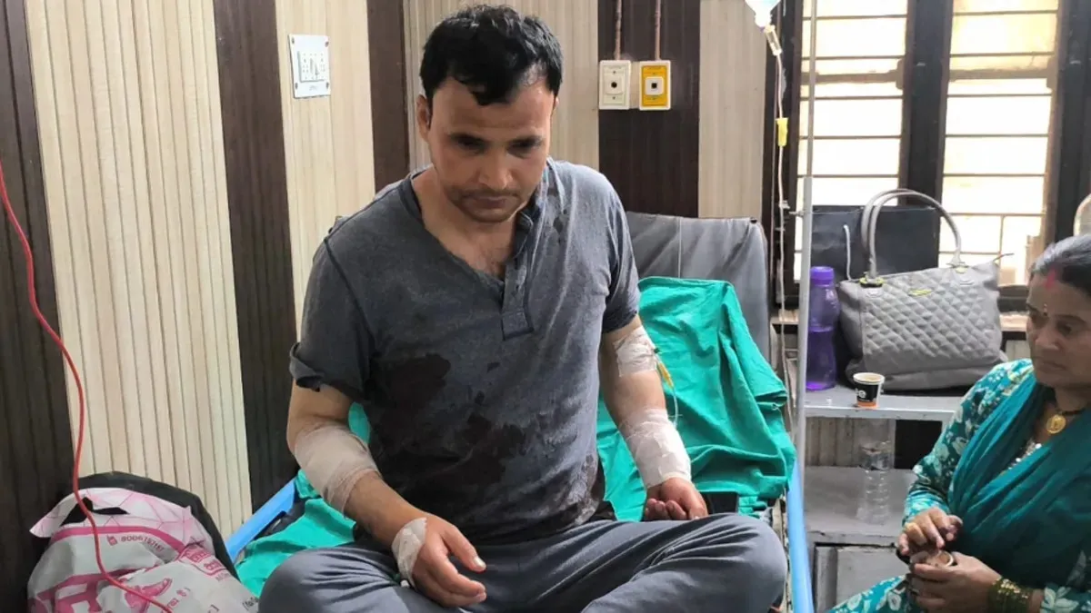 नई स्कूटी ले गया पति, तिलमिलाई पत्नी ने धारदार हथियार से किया लहूलुहान – Khabar Uttarakhand